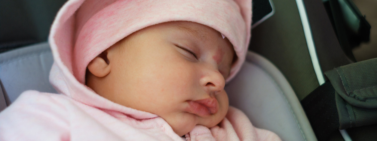 Ein Baby mit Storchenbiss an der Stirn