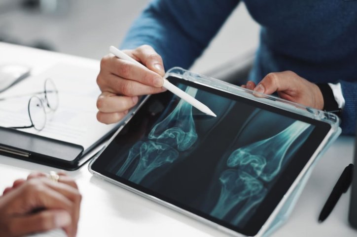 Arzt erklärt Patientin eine Röntgenaufnahme der Knie