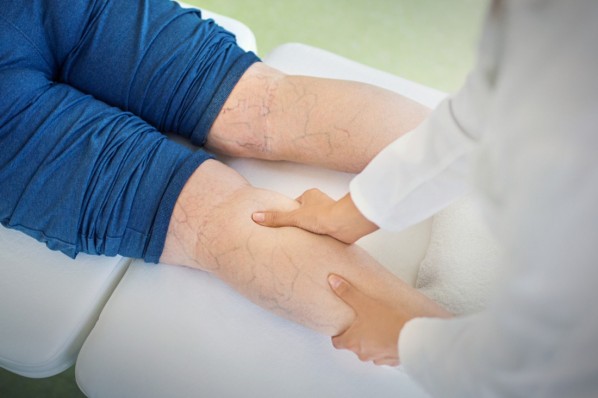 Ärztin untersucht Krampfadern einer Patientin