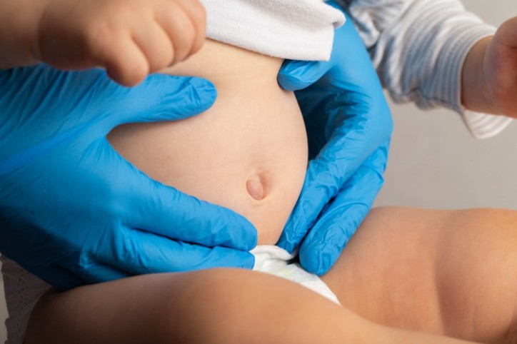 Baby wird auf Nabelbruch untersucht.