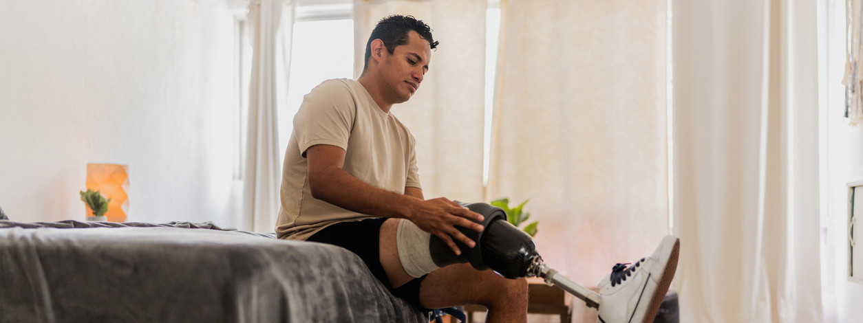 Ein Mann sitzt mit einer Beinprothese auf einem Bett