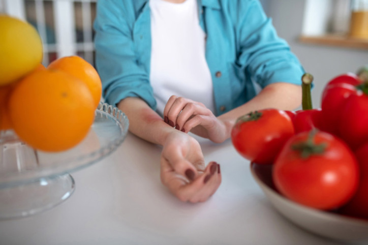 Eine Lebensmittelallergie führt zu Juckreiz am Arm