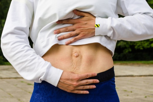 Junge Frau zeigt ihren Bauch nach einer Rektusdiastase.