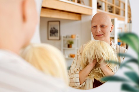 Eine Frau mit Glatze schaut in einen Spiegel und hält eine blonde Perücke in der Hand.