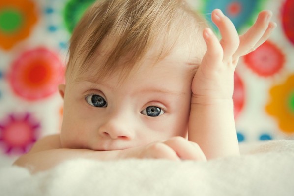 Ein Baby mit Down-Syndrom.