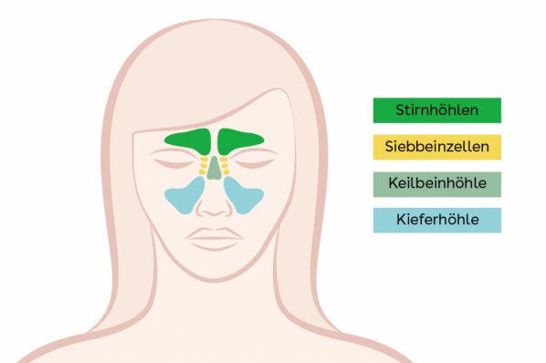 C-Content Nasennebenhöhlenentzündung 2