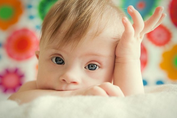 Ein Baby mit Down-Syndrom.