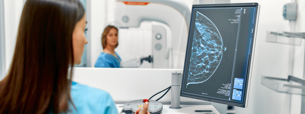 Eine Ärztin schaut auf ein Screeningbild einer Brust. Eine Patientin lässt im Hintergrund eine Mammographie durchführen.