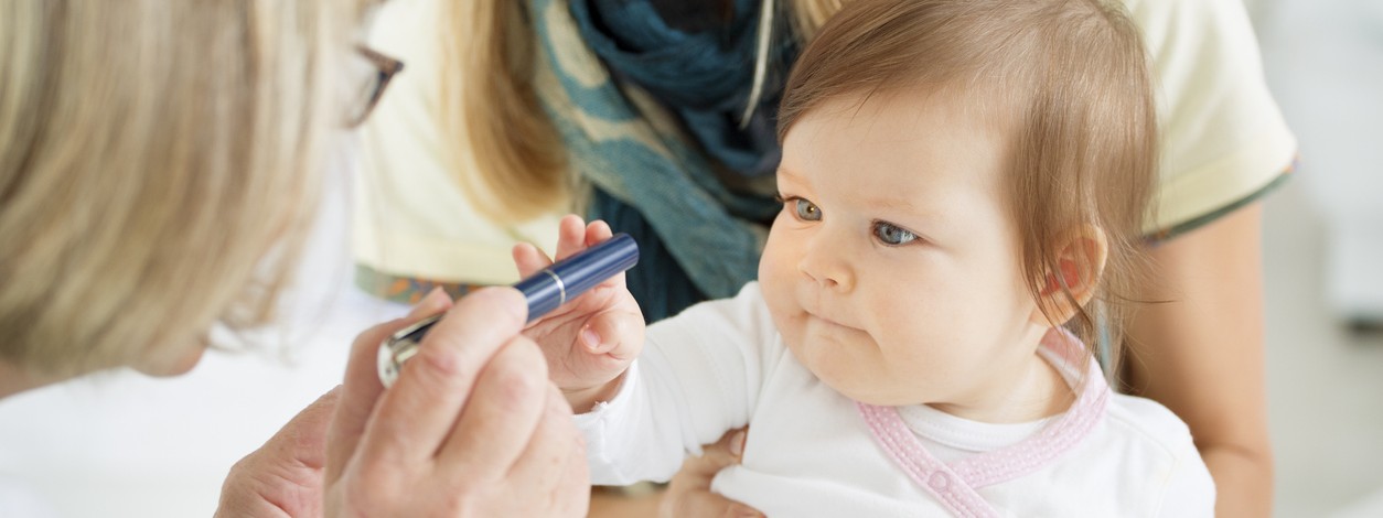 Ein Baby wird auf Amblyopie untersucht.