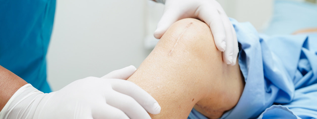 Ein Arzt untersucht das Knie eines Patienten nach OP