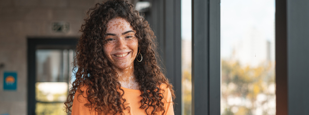 Lächelnde Frau Mitte 20 am Fenster mit Vitiligo