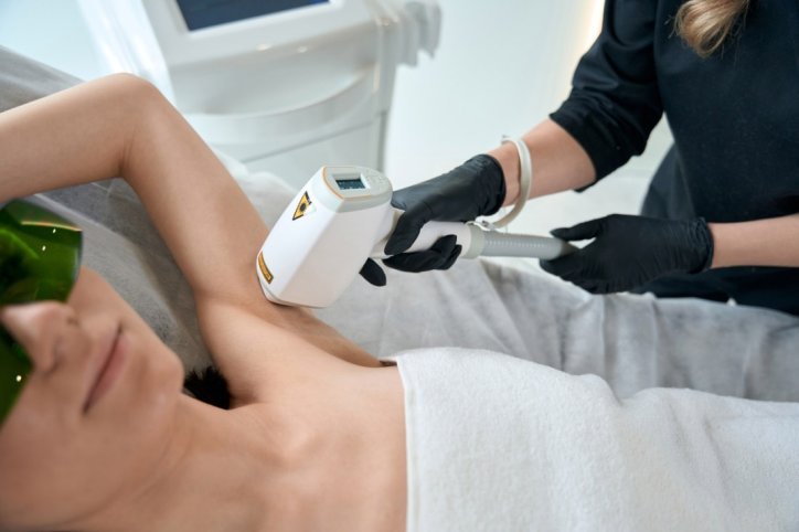 Eine Frau lässt sich Haare mithilfe einer Laserbehandlung entfernen