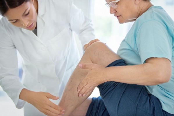Ärztin untersucht Krampfadern einer Patientin
