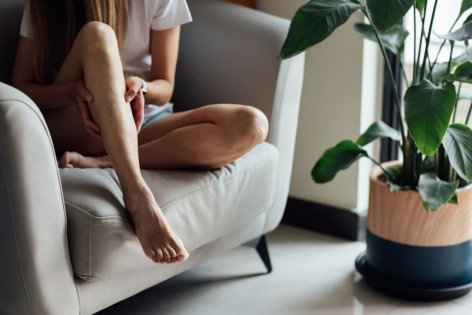 Frau mit X-Beinen begutachtet ihr Bein auf einem Sessel