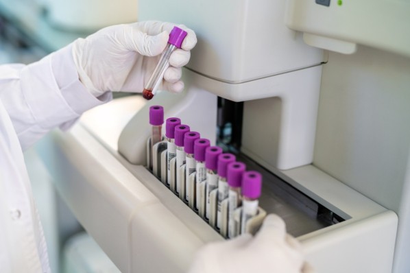 Proben eines Krebstests im Labor